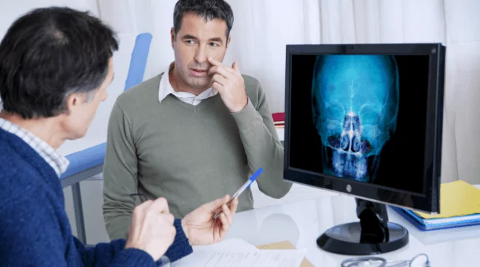 Pacjent chory na zapalenie zatok rozmawia z lekarzem w jego gabinecie, na ekranie monitora widać prześwietloną czaszkę z widocznymi drogami oddechowymi